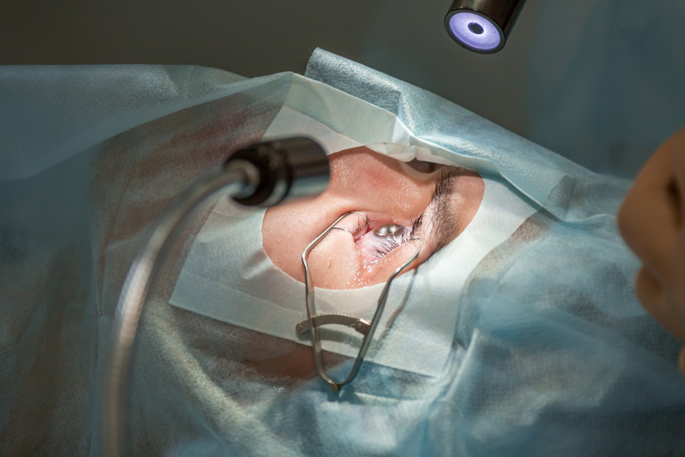 Understanding LASIK Istanbul: Benefits, Procedures, and Expectations