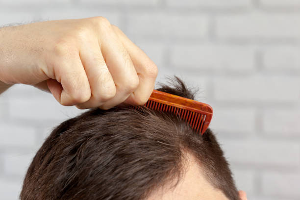 Hair Transplant Cost in Turkey: Why Thousands Choose Istanbul