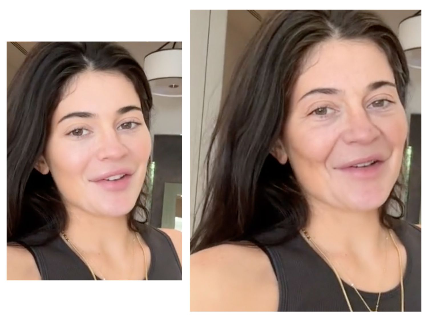 Gilmore Health News: The Growing Concern Over AI Beauty Filters and Self-Image